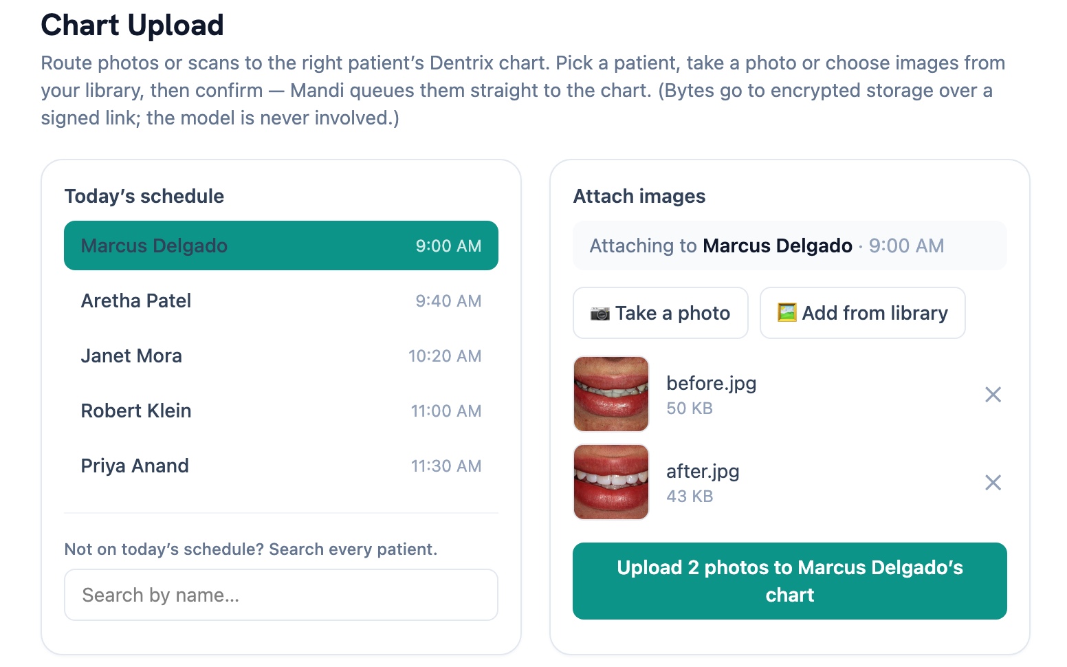Mandi Chart Upload: pick the patient from today's schedule, add before/after photos, and attach them to the Dentrix chart